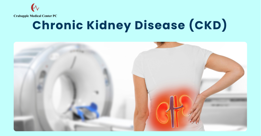 CKD CKD