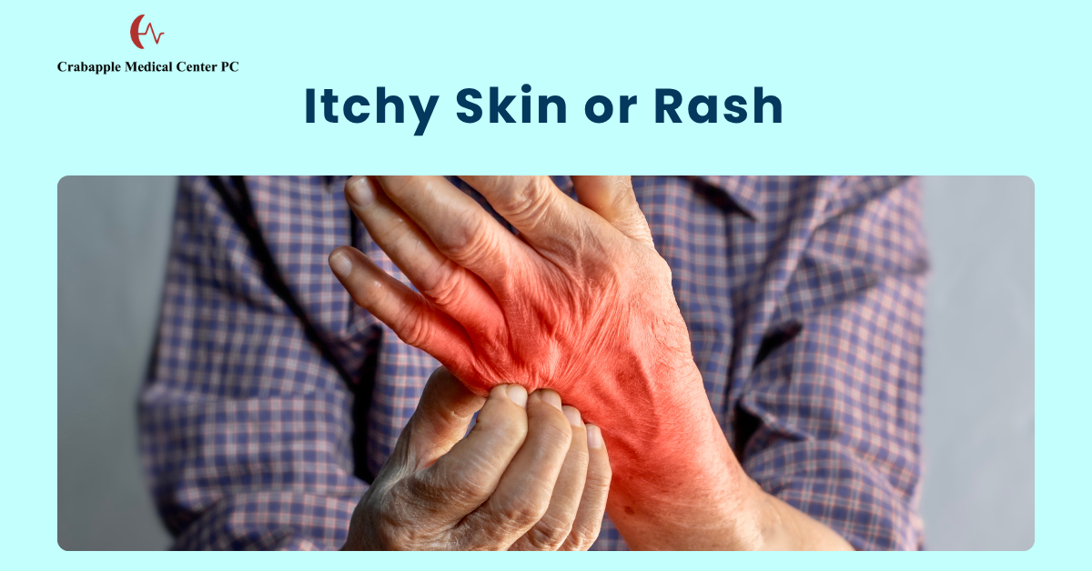 Itchy Skin or Rash