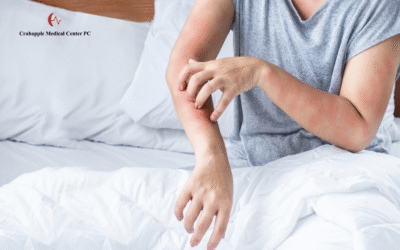 Managing Acute Allergic Reactions | Immediate Steps To Take