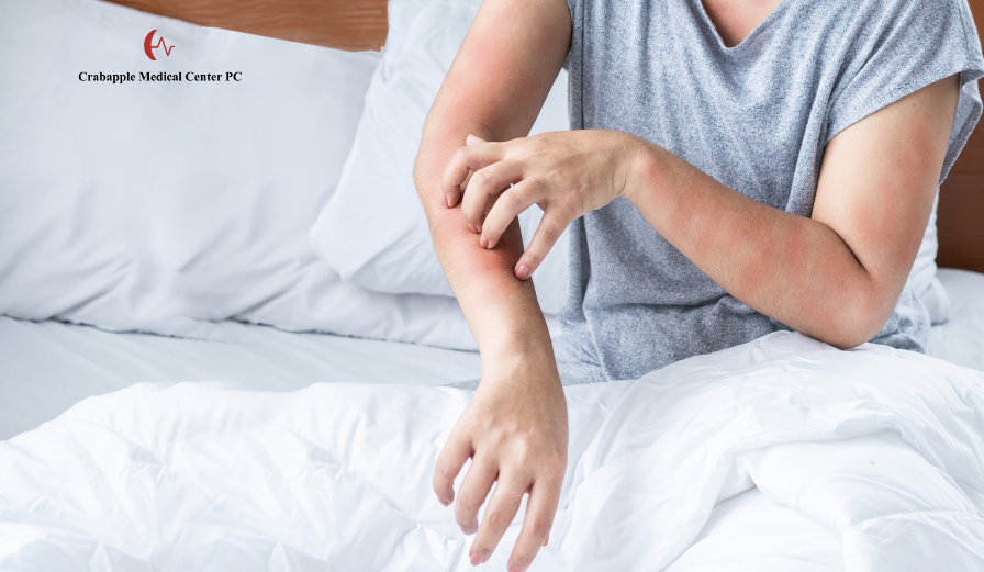 Managing Acute Allergic Reactions Immediate Steps to Take