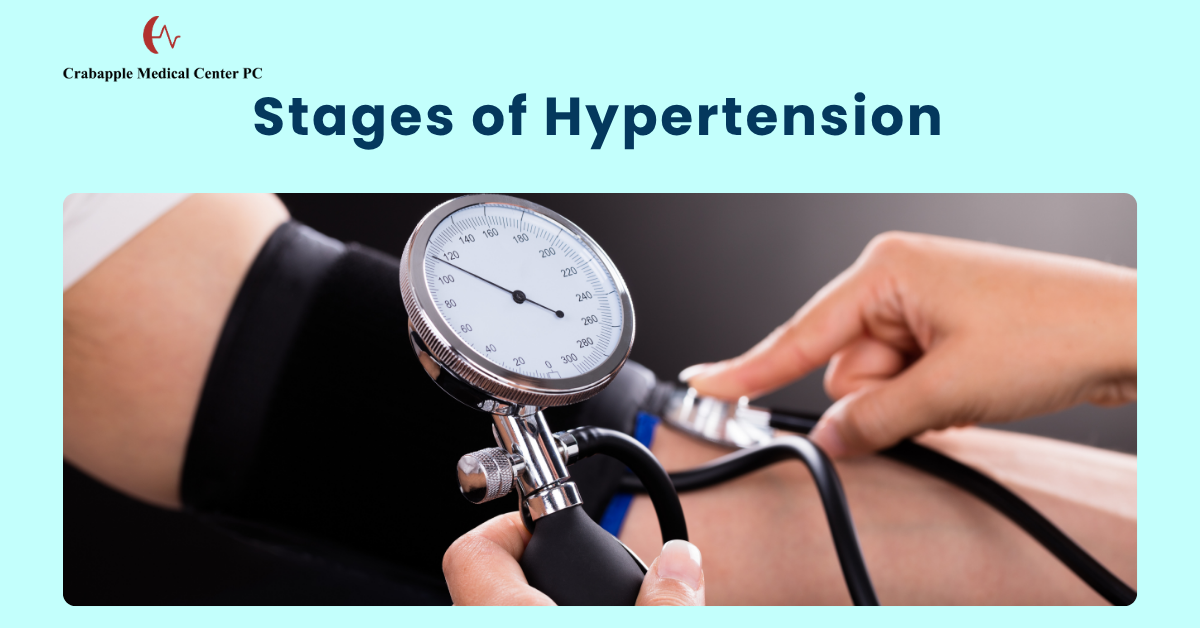 Stages of Hypertension Stages of Hypertension