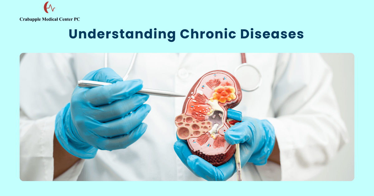 Understanding Chronic Diseases Understanding Chronic Diseases
