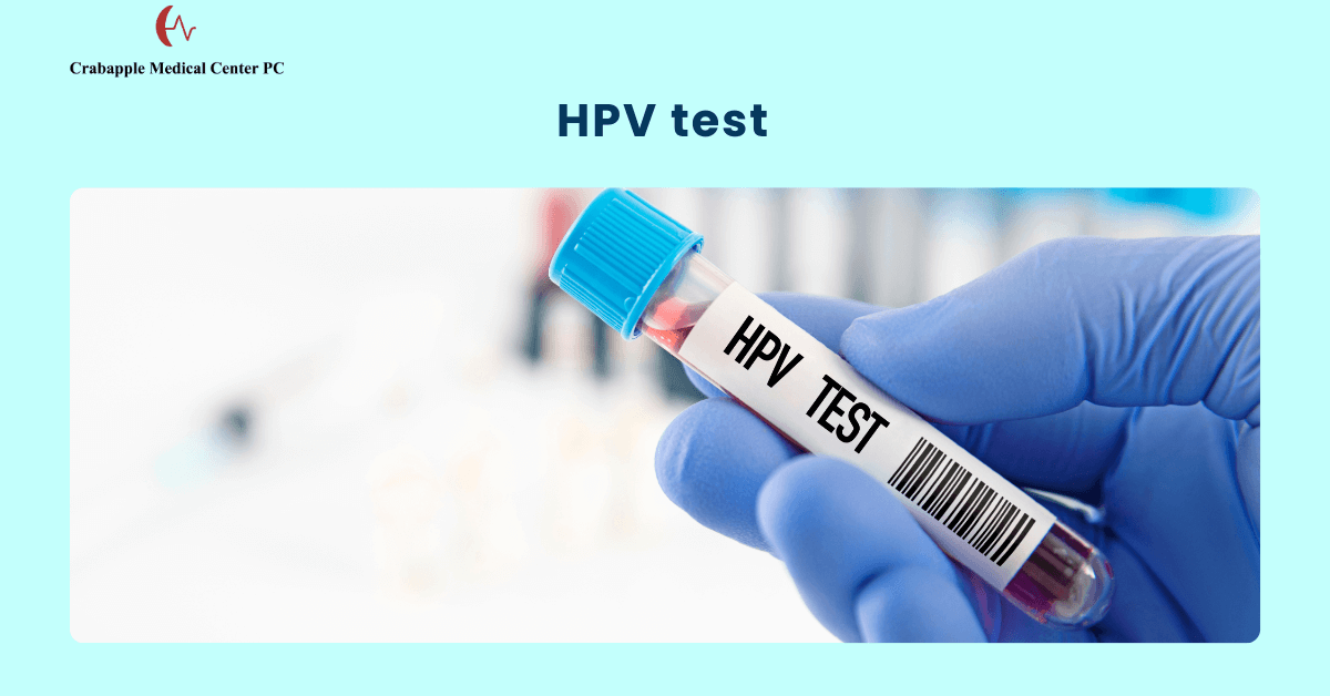 HPV Test