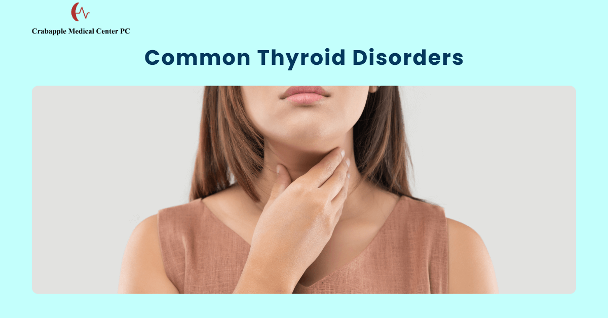 Common Thyroid Disorders Common Thyroid Disorders