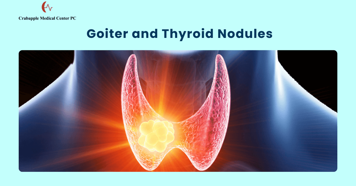 _Goiter and Thyroid Nodules _Goiter and Thyroid Nodules